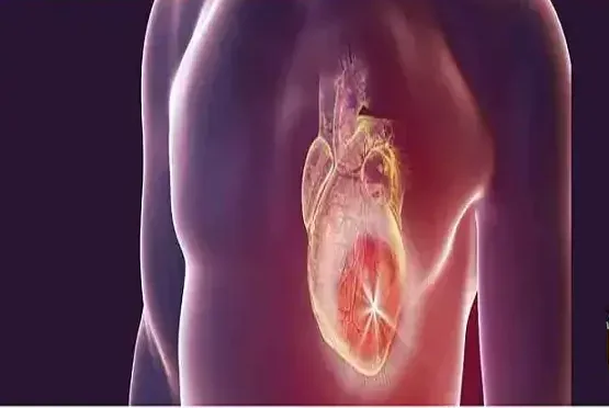 prevenir infarto