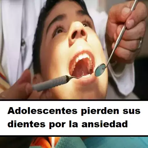 adolescentes pierden sus dientes
