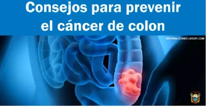 consejos prevenir cáncer colon