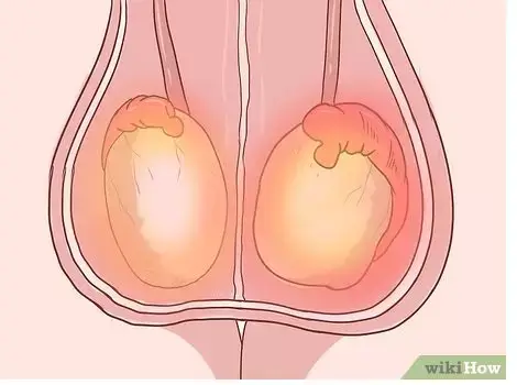 cómo quitar el dolor de los testículos