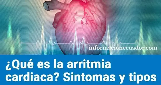qué es la arritmia cardiaca síntomas y tipos