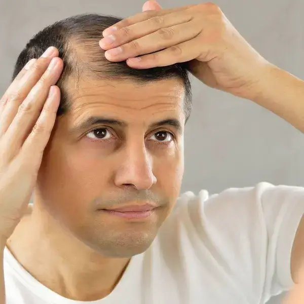 cómo prevenir la caída del cabello